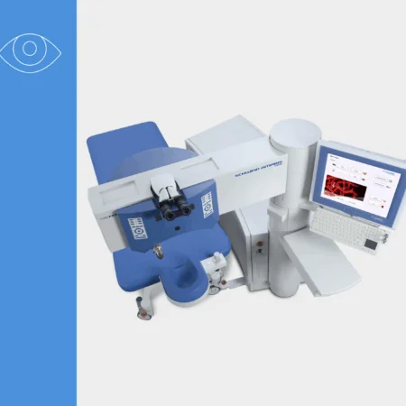 The Powerful Performance Excimer Laser