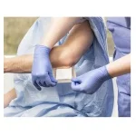 Cardinal Healthâ„¢ Silicone Bordered Foam Dressing, 5-Layer 1 Silicone Bordered Foam Dressing_Lifestyle-Elbow